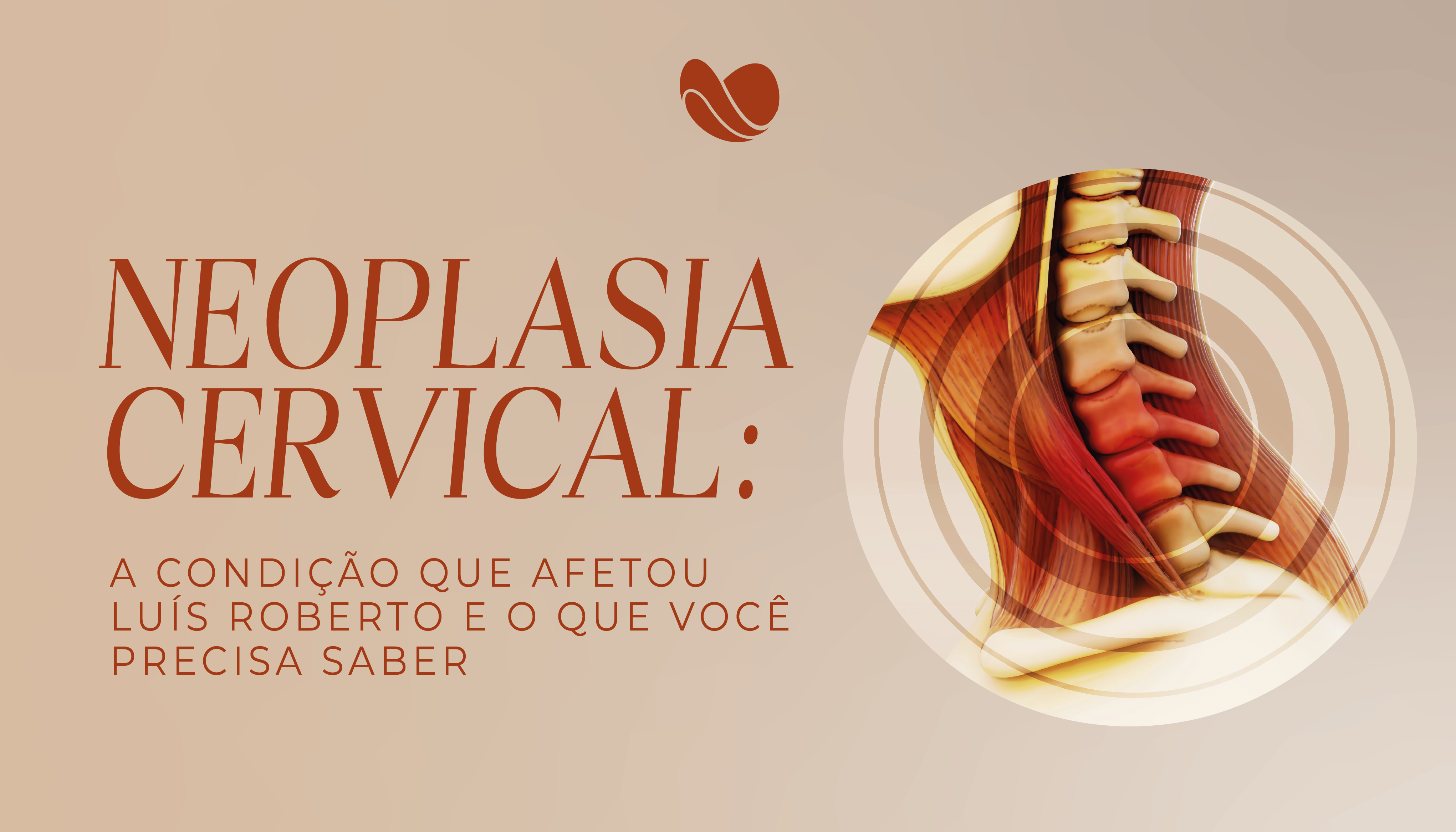 Neoplasia cervical: a condição que afetou Luís Roberto e o que você precisa saber